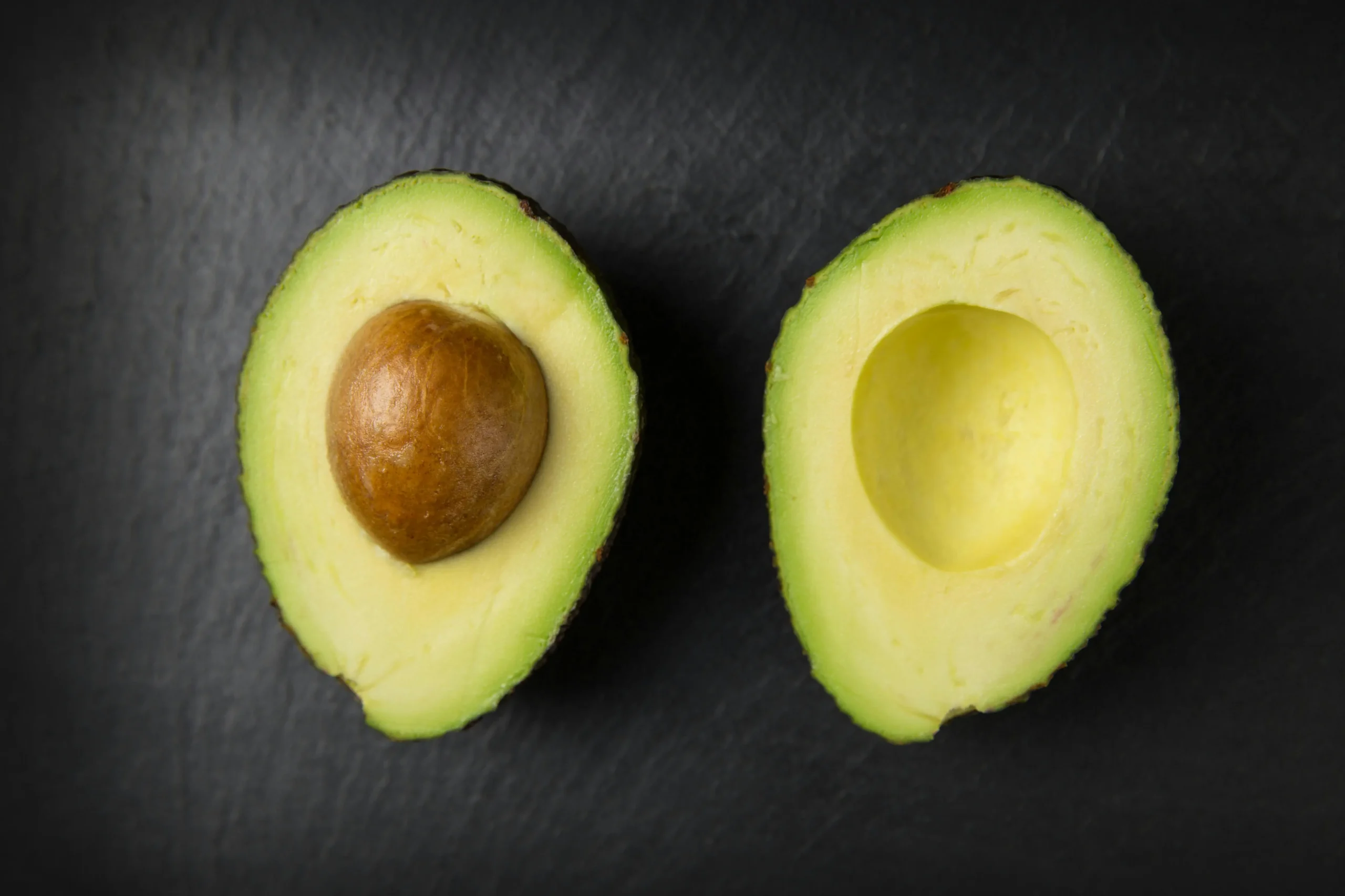 Wondering what avocado oil does for your skin? Discover its top benefits—hydration, healing, and anti-ageing. Click now for the full skincare breakdown!