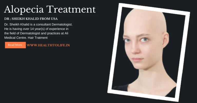 Alopecia Treatment