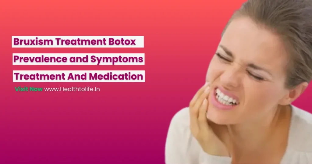 Bruxism Treatment Botox