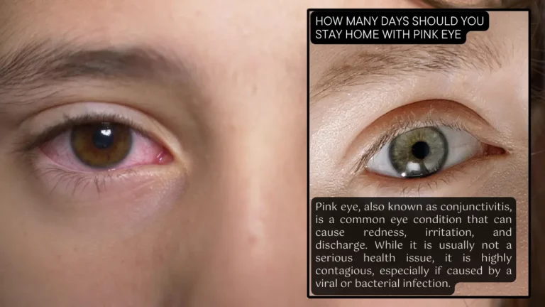 How Many Days Should You Stay Home With Pink Eye